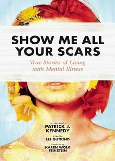 Show Me All Your Scars: True Stories of Living with Mental Illness, Paperback