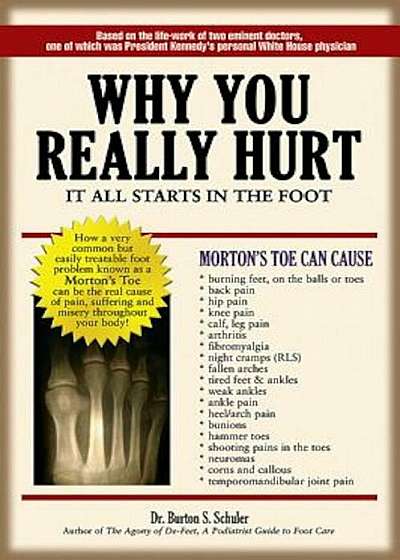 Why You Really Hurt: It All Starts in the Foot, Paperback
