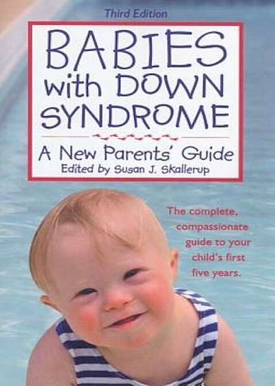 Babies with Down Syndrome: A New Parents' Guide, Paperback