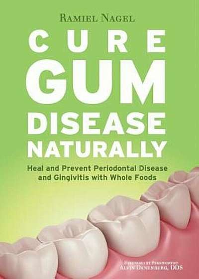 Cure Gum Disease Naturally: Heal Gingivitis and Periodontal Disease with Whole Foods, Paperback