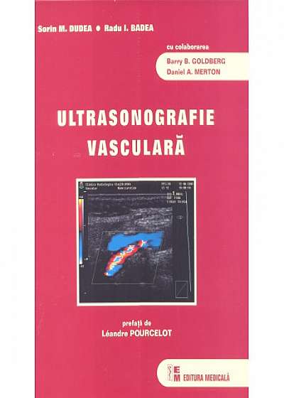 Ultrasonografie vasculara