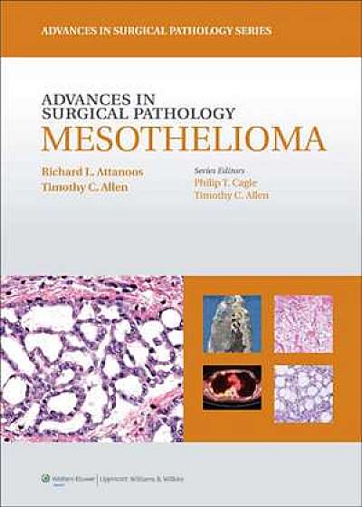 Advances in Surgical Pathology: Mesothelioma