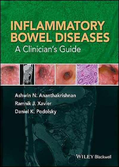 Coperta cărții Inflammatory Bowel Diseases