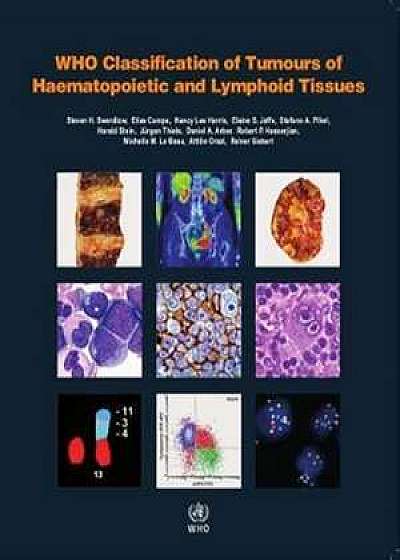 WHO Classification of Tumours of Haematopoietic and Lymphoid Tissues (Revised)