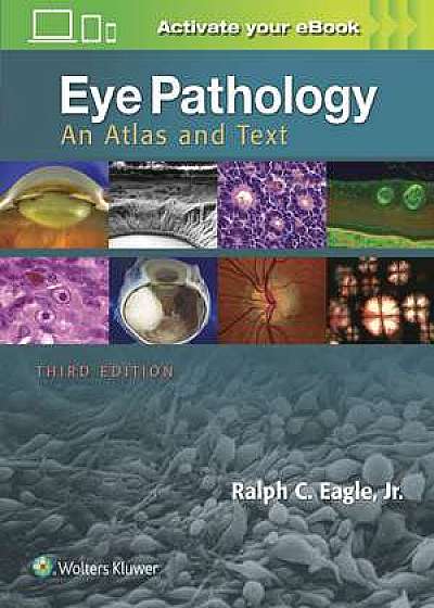Eye Pathology