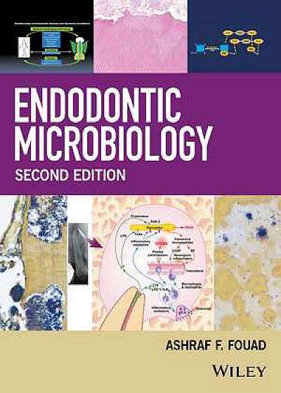 Coperta cărții Endodontic Microbiology