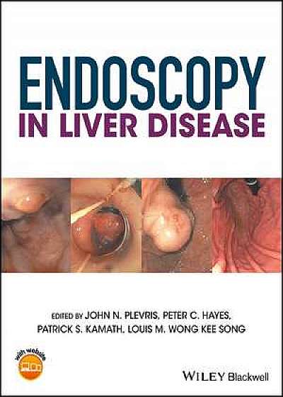 Coperta cărții Endoscopy in Liver Disease