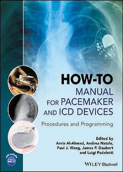 How–to Manual for Pacemaker and ICD Devices