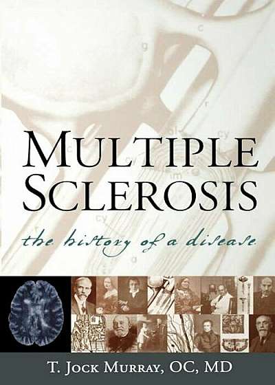 Multiple Sclerosis: The History of a Disease, Paperback
