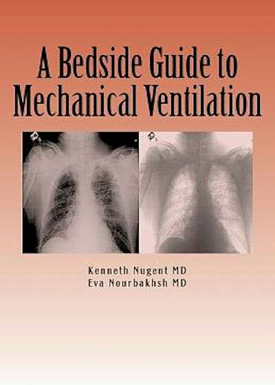 A Bedside Guide to Mechanical Ventilation, Paperback