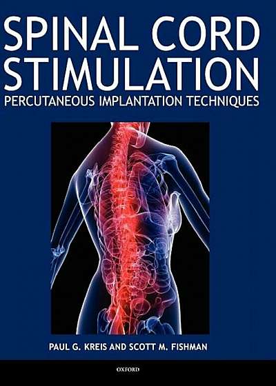 Spinal Cord Stimulation: Percutaneous Implantation Techniques, Hardcover