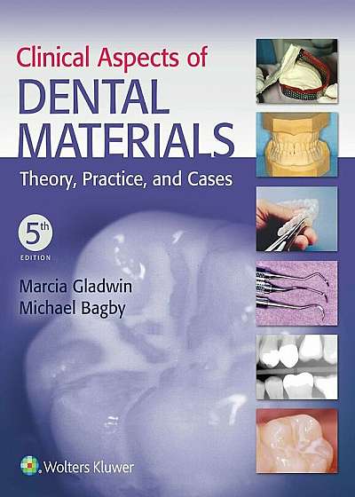 Clinical Aspects of Dental Materials: Theory, Practice, and Cases, Paperback