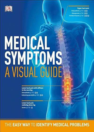 Medical Symptoms: A Visual Guide: The Easy Way to Identify Medical Problems, Paperback