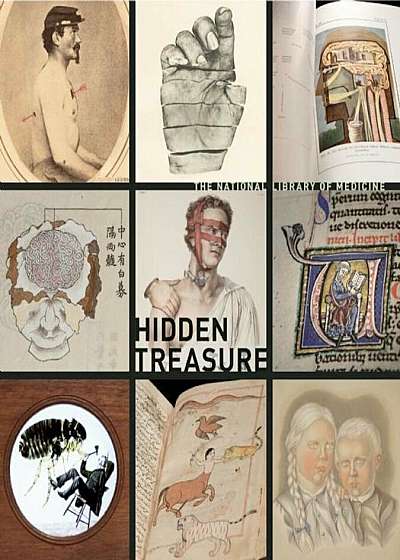 Hidden Treasure: The National Library of Medicine, Hardcover