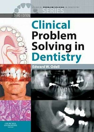 Clinical Problem Solving in Dentistry, Paperback