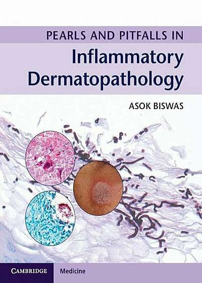 Pearls and Pitfalls in Inflammatory Dermatopathology, Hardcover
