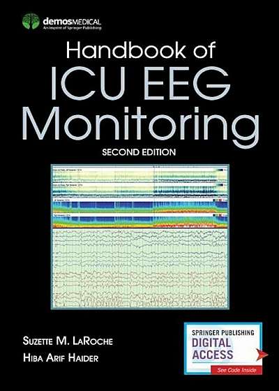 Handbook of ICU Eeg Monitoring, Second Edition, Paperback