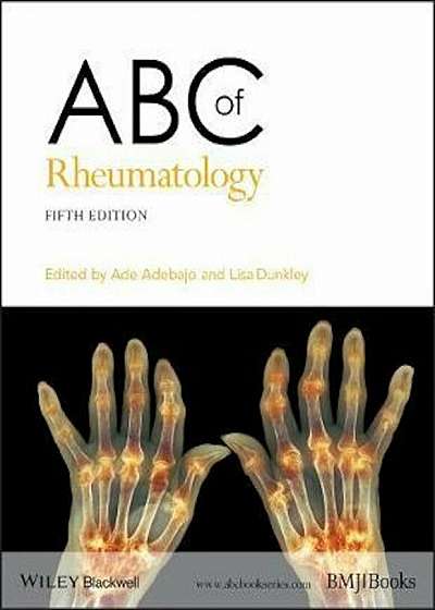 ABC of Rheumatology, Paperback
