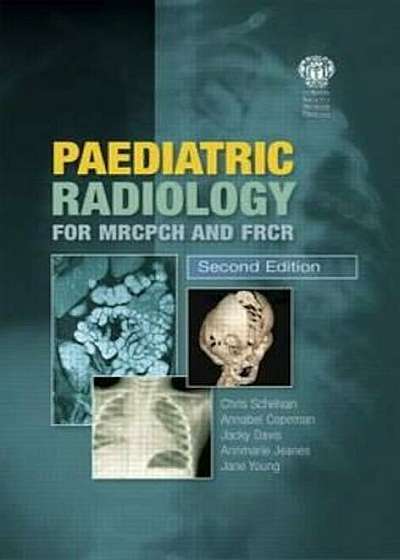 Paediatric Radiology for MRCPCH and FRCR, Second Edition, Paperback