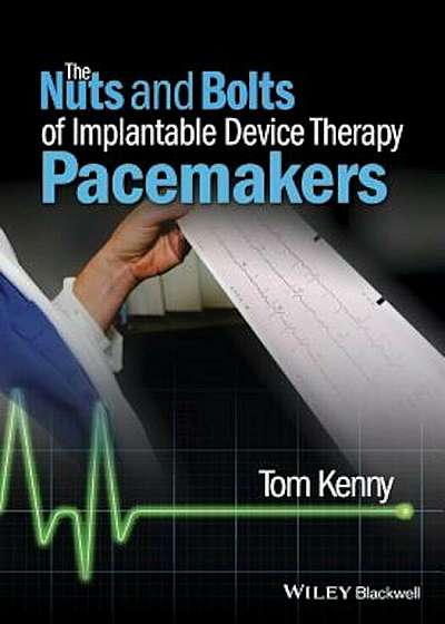 The Nuts and Bolts of Implantable Device Therapy: Pacemakers, Paperback