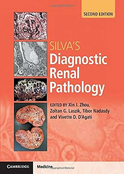 Silva's Diagnostic Renal Pathology, Hardcover