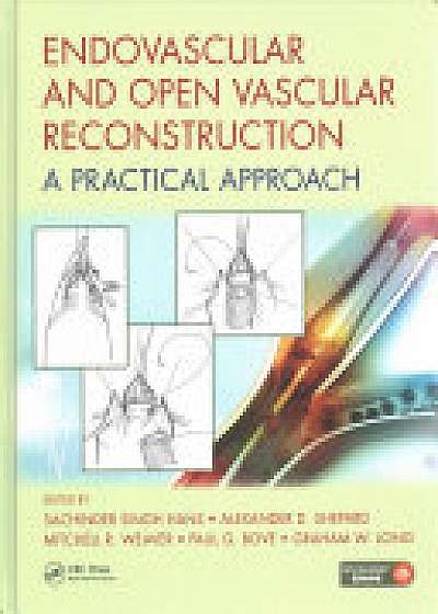 Endovascular and Open Vascular Reconstruction