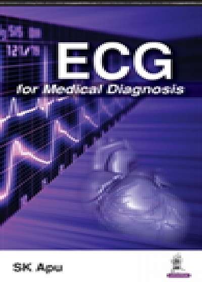 ECG for Medical Diagnosis
