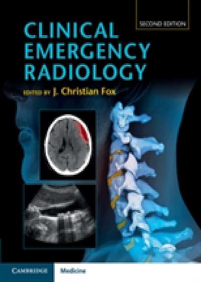 Coperta cărții Clinical Emergency Radiology