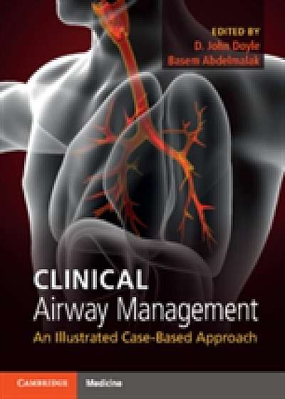 Coperta cărții Clinical Airway Management