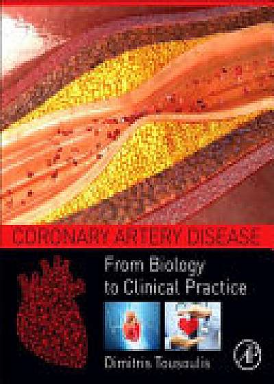 Coperta cărții Coronary Artery Disease