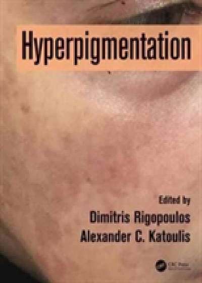 Coperta cărții Hyperpigmentation
