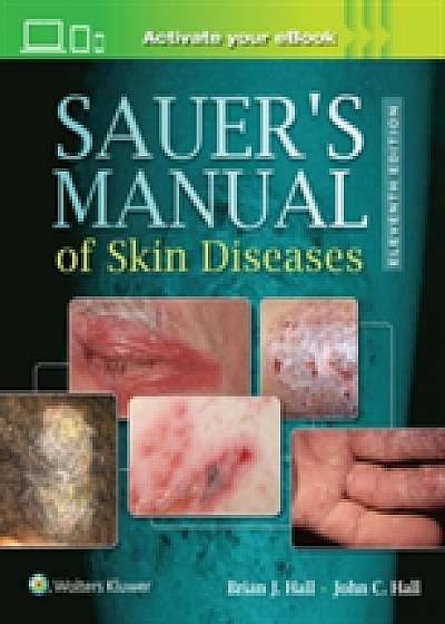 Sauer's Manual of Skin Diseases