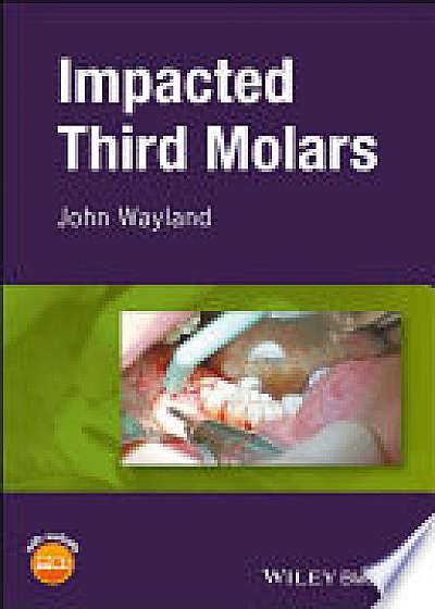 Coperta cărții Impacted Third Molars