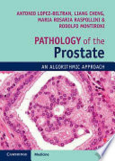 Pathology of the Prostate