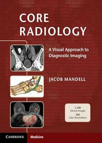 Core Radiology: A Visual Approach to Diagnostic Imaging, Paperback/Jacob Mandell