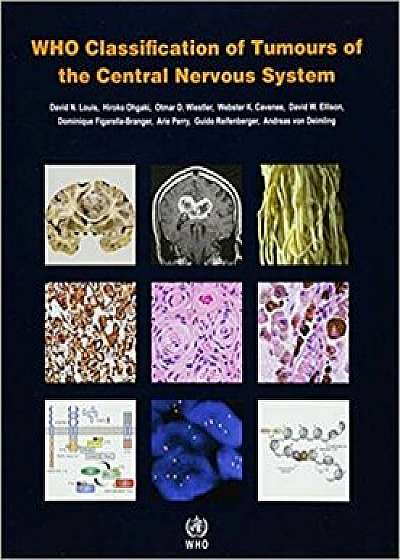 WHO Classification of Tumours of the Central Nervous System, Paperback (4th Ed.)/International Agency for Research on Can