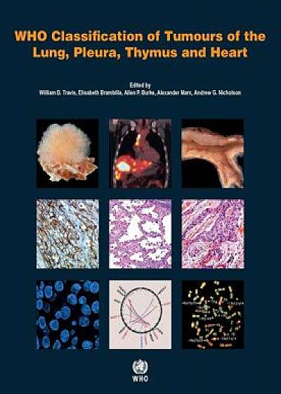 Who Classification of Tumours of the Lung, Pleura, Thymus and Heart, Paperback (4th Ed.)/International Agency for Research on Can