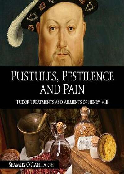 Pustules, Pestilence and Pain: Tudor Treatments and Ailments of Henry VIII, Paperback/Seamus O'Caellaigh