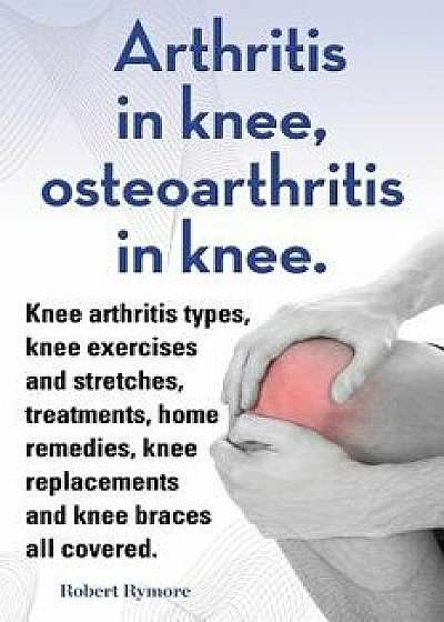 Arthritis in Knee, Osteoarthritis in Knee. Knee Arthritis Types, Knee Exercises and Stretches, Treatments, Home Remedies, Knee Replacements and Knee B, Paperback/Robert Rymore