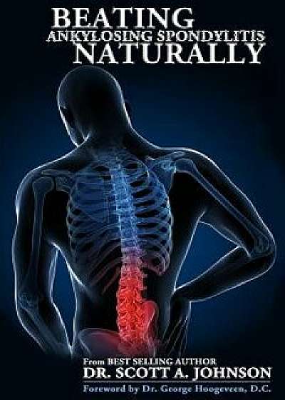 Beating Ankylosing Spondylitis Naturally, Paperback/Dr Scott a. Johnson