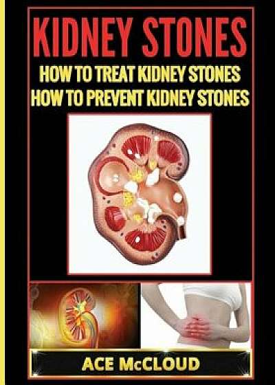 Kidney Stones: How to Treat Kidney Stones: How to Prevent Kidney Stones, Paperback/Ace McCloud
