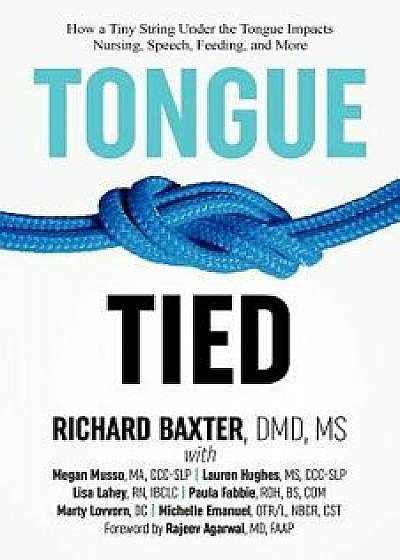 Tongue-Tied: How a Tiny String Under the Tongue Impacts Nursing, Speech, Feeding, and More, Paperback/DMD MS Baxter