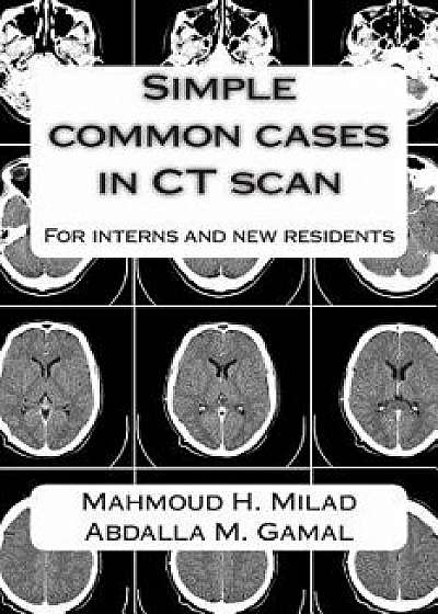 Simple Common Cases in CT Scan: For Interns and New Residents, Paperback/Dr Mahmoud H. Milad