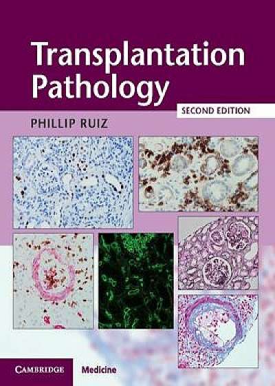 Transplantation Pathology Hardback with Online Resource, Hardcover/Phillip Ruiz