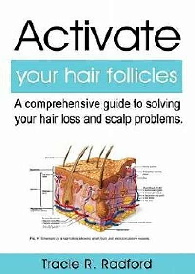 Activate Your Hair Follicles: A Comprehensive Guide to Solving Your Hair Loss and Scalp Problems, Paperback/Beverly Crockett