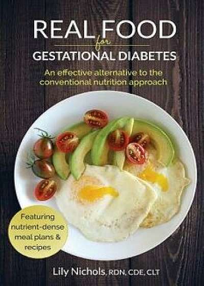 Real Food for Gestational Diabetes: An Effective Alternative to the Conventional Nutrition Approach, Paperback/Lily Nichols