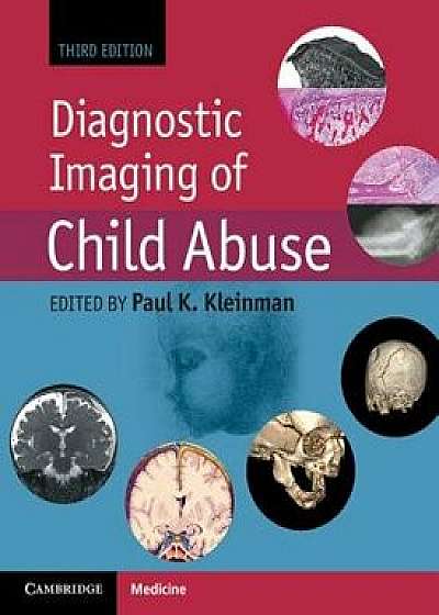 Diagnostic Imaging of Child Abuse, Hardcover/Paul K. Kleinman