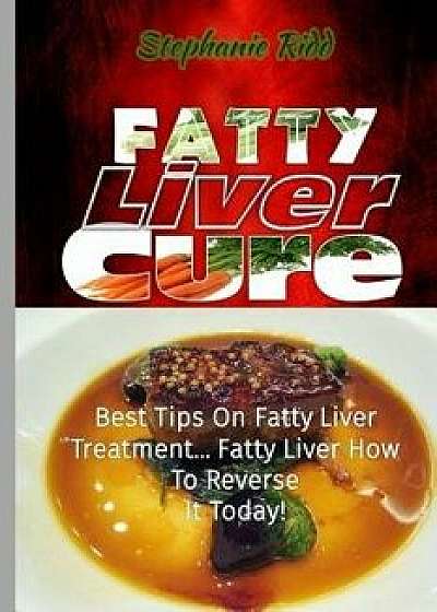 Fatty Liver Cure: Best Tips on Fatty Liver Treatment... Fatty Liver How to Reverse It Today!, Paperback/Stephanie Ridd
