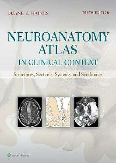 Neuroanatomy Atlas in Clinical Context: Structures, Sections, Systems, and Syndromes, Paperback/Duane E. Haines