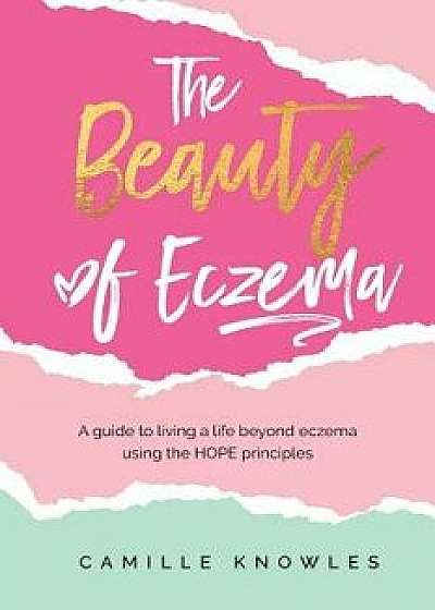 The Beauty of Eczema: A Guide To Living a Life Beyond Eczema Using The Hope Principles, Paperback/Camille Knowles